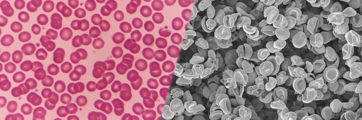 光学顕微鏡と電子顕微鏡で観察した赤血球のイメージ